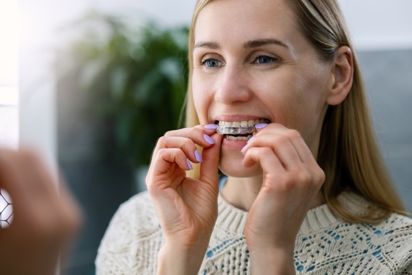 Clear Aligners From A General Dentist